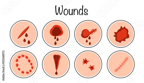 Wounds