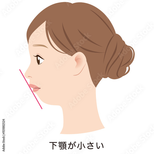 下顎が小さい口元　アデノイド顔貌　Eライン　横顔