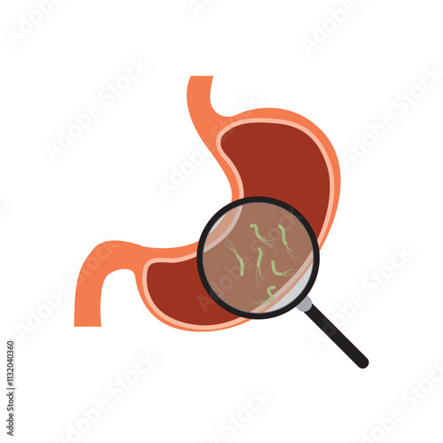 Helicobacter Pylori in the stomach. Stomach diseases. Bacterium with flagella that causes gastritis. Bacteria under magnifying glass. Vector illustration on white background