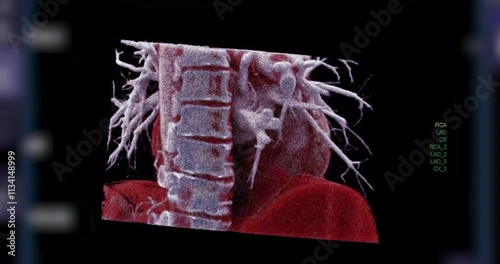 Realistic 3D Heart CTA Scan: A detailed CTA scan showing the coronary arteries and heart structure, providing a comprehensive view for clinical evaluation. photo