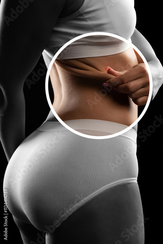 Folds of fat on the belly of a young woman on a white background.Treatment and disposal of excess weight, the deposition of subcutaneous fat.