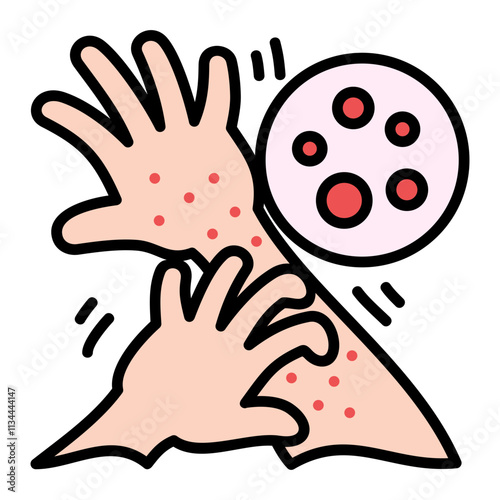 Itching