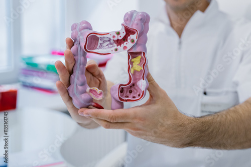 Male colon surgeon holding anatomical model for diagnosis and treatment in hospital, intestinal diseases, stomach ulcers and intestinal modia photo