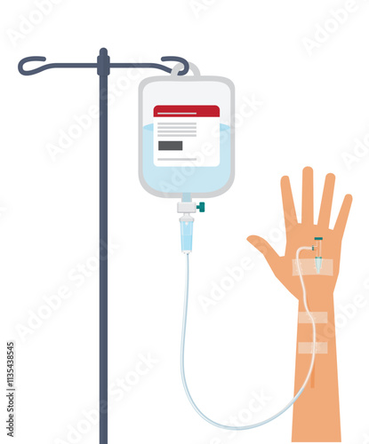 Intravenous drip infusion in hand. stock illustration