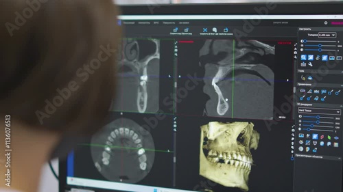 dentistry. orthodontics. human jaw image. panoramic dental image. 3d. modern medical technologies. fluorography jaw image and human teeth structure in the image