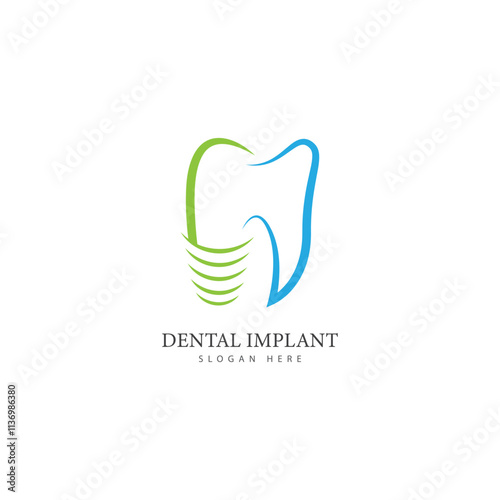 dental implant logo design concept vector dental care logo template