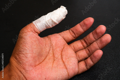 Thump finger human hand with accident wound 