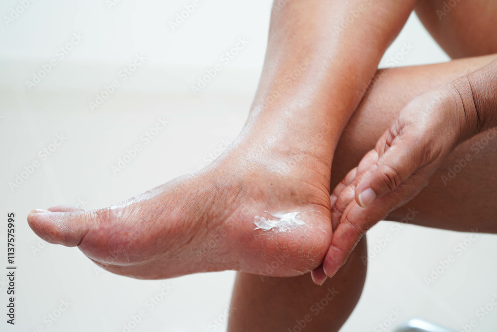 Fototapeta premium Asian woman applying moisturizing cream skincare treatment to solve and repair feet with crack and dry heel skin.