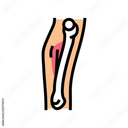 hairline fracture color icon vector. hairline fracture sign. isolated symbol illustration