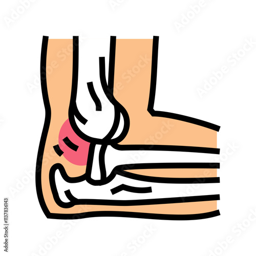 dislocated joint fracture color icon vector. dislocated joint fracture sign. isolated symbol illustration