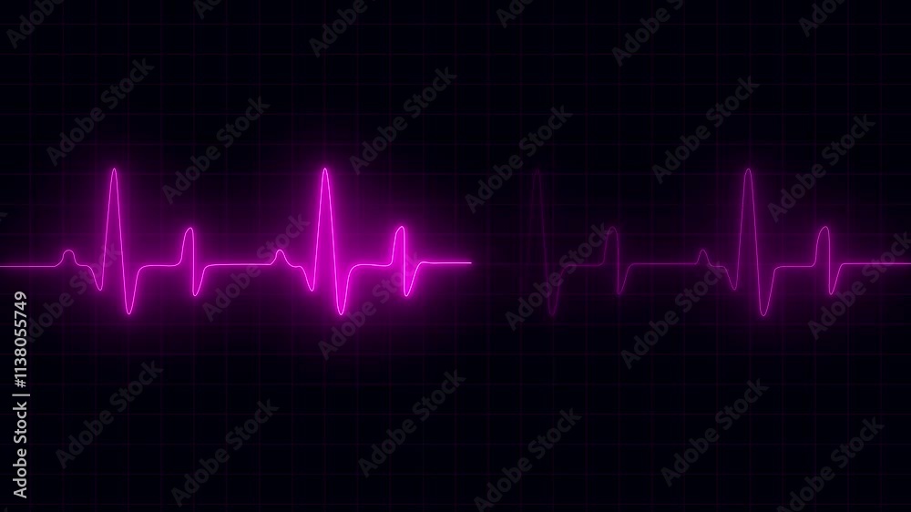 Neon Electrocardiogram Heartbeat Pulse Heart attack monitoring Medical Patient Treatment Display Background Loop.