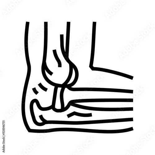 dislocated joint fracture line icon vector. dislocated joint fracture sign. isolated contour symbol black illustration