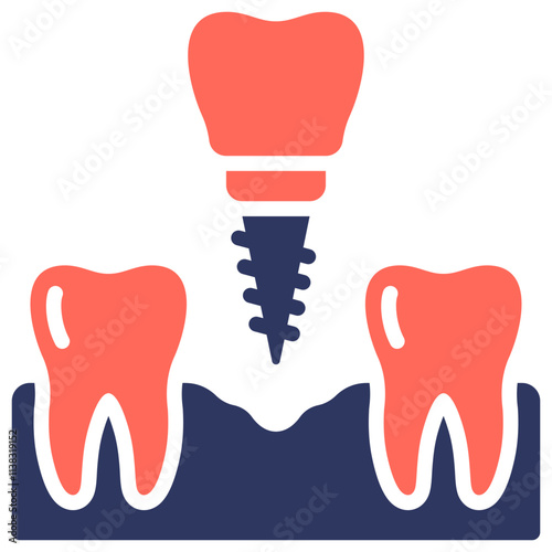 Dental Implant Icon