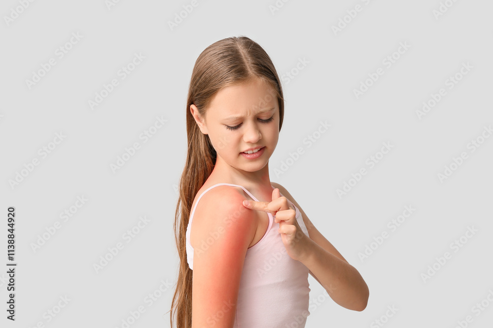 Little girl touching red sunburned skin on grey background Little girl touching red sunburned skin on grey background
