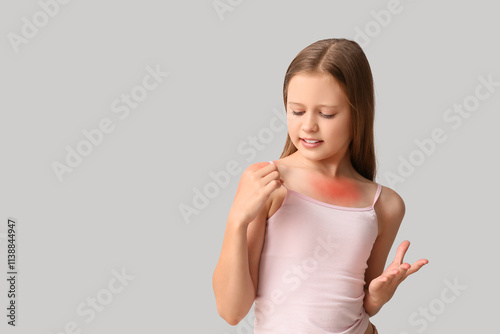 Little girl with red sunbur...