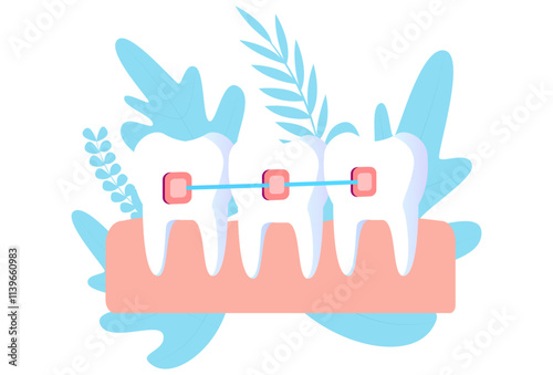 Tooth Braces Concept Illustration Stylish and Beautiful