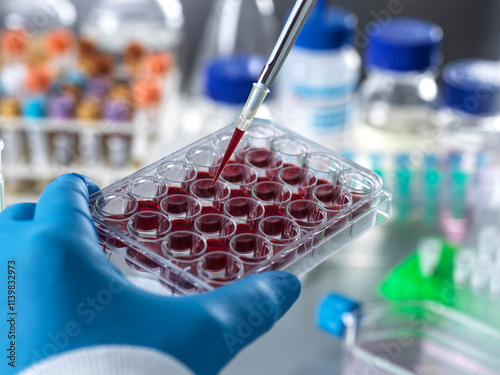 Haematology research