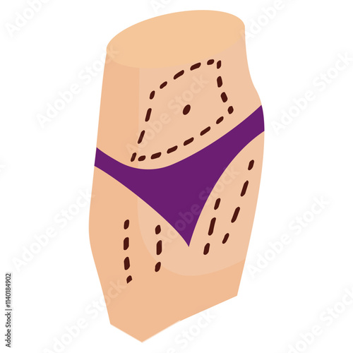 lipoplasty and body contouring isometric concept, Panniculectomy surgery vector icon design, beauty personal care symbol, cosmetic dermatology sign, body aesthetics stock illustration 