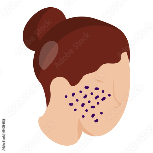 Acne Treatment isometric concept, Skin Resurfacing or Microdermabrasion vector icon design, beauty personal care symbol, cosmetic dermatology sign, body aesthetics stock illustration 