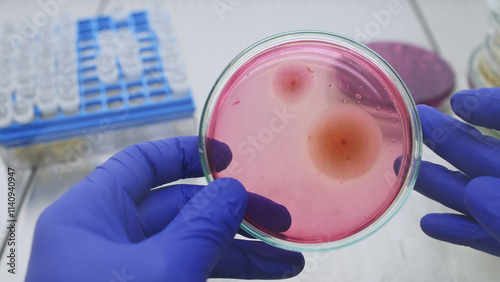 Scientist holding petri dish in hands with a large colony of bacteria on a red medium. Laboratory study of bacteria.