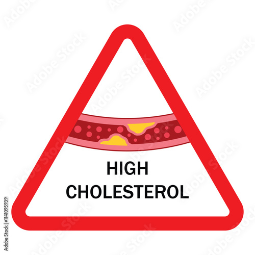 High blood cholesterol icon with a arteriosclerosis risk in a red warning triangle. Clogged artery. Concept of unhealthy lifestyle, fast food. thrombosis microvascular disease. Vector illustration 