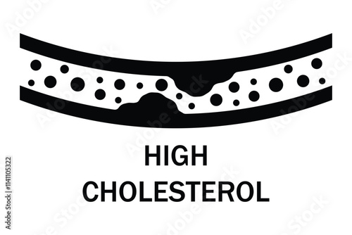 High blood cholesterol icon with a arteriosclerosis risk. Clogged artery. Warning concept of high cholesterol and unhealthy lifestyle, fast food. thrombosis microvascular disease. Vector illustration