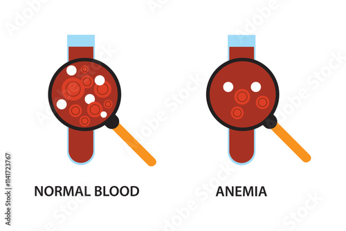 Anemia problem circulatory iron body diagram background. Anaemia biology blood isolated medical normal icon