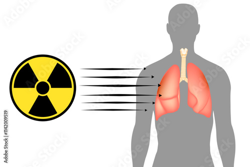 Radiation Exposure on Human Lungs. Human Body Radiation Penetration. Medical Radiation Risk Illustration. Radiation and Health Damage Visualization