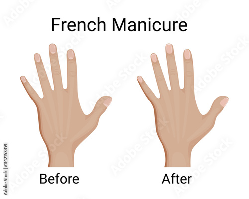 Before and after French manicure vector illustration design