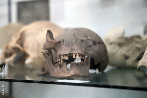 
Forensic anthropology. Human bone remains for study in a laboratory showcase.
