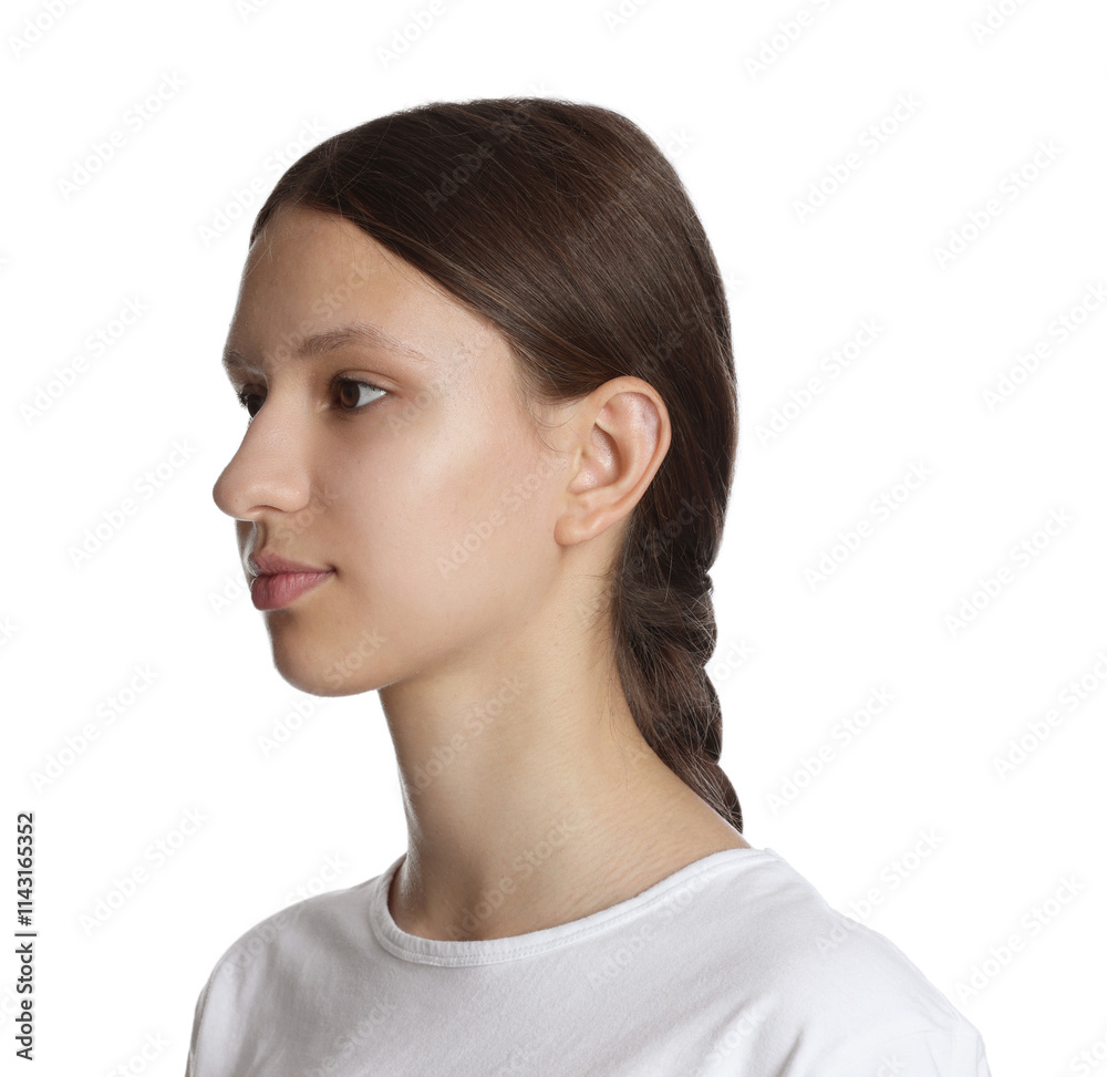 Teenage girl with acne problem on white background Teenage girl with acne problem on white background