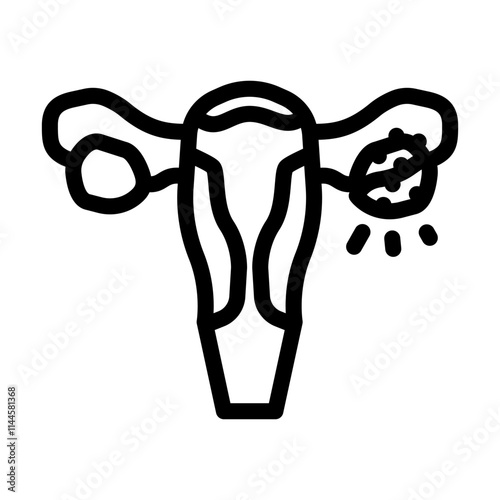 ovarian cancer woman disease line icon vector. ovarian cancer woman disease sign. isolated contour symbol black illustration