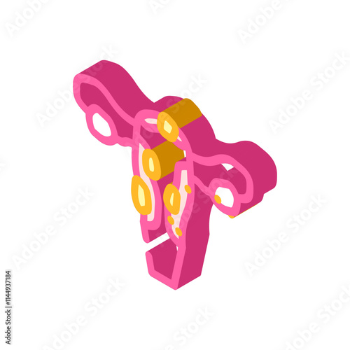 uterine fibroids woman disease isometric icon vector. uterine fibroids woman disease sign. isolated symbol illustration