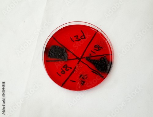 Bild auf Leinwand bacterial gowth on Congo red agar plate to test the ability of bacteria to brodu