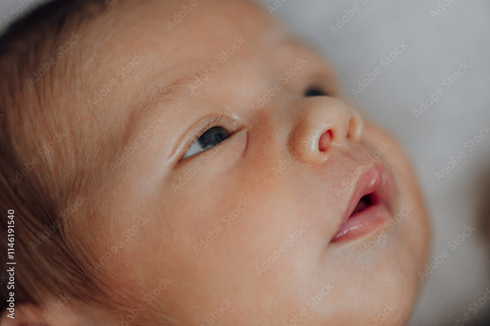 A baby with a blue eye and a pink nose. The baby is looking up at the camera A baby with a blue eye and a pink nose. The baby is looking up at the camera