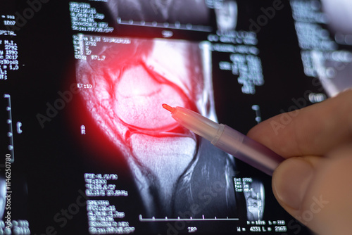 Photography Doctor learning Knee joint MRI