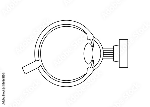LASIK eye surgery