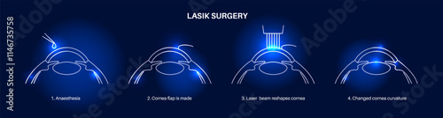 LASIK eye surgery