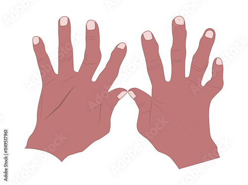 illustration of an old hand with bent and weathered fingers, symbolizing the resilience and dedication of a hard worker. Ideal for highlighting themes of hard work, aging, wisdom and the human story