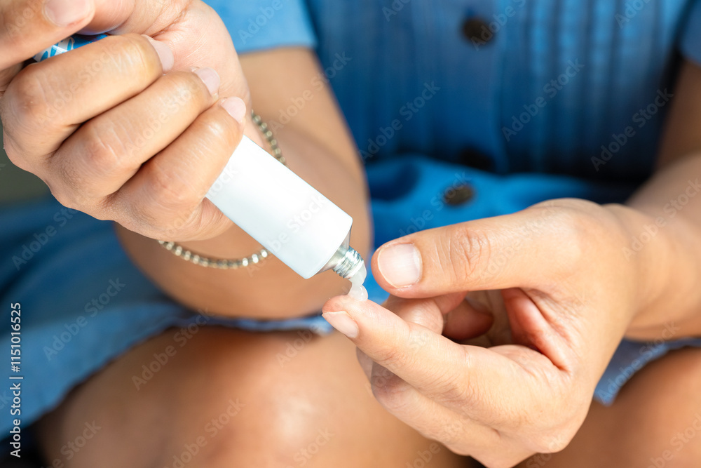 The woman's hand, she is Use steroids Apply External type
The woman's hand, she is Use steroids Apply External type