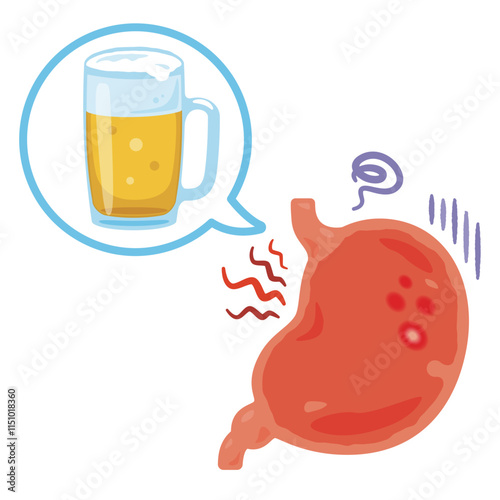 アルコールで炎症が起きた胃のイラスト