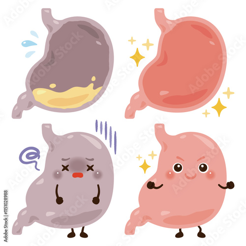 胃酸不足状態の胃のキャラクターと元気な胃のキャラクターイラスト