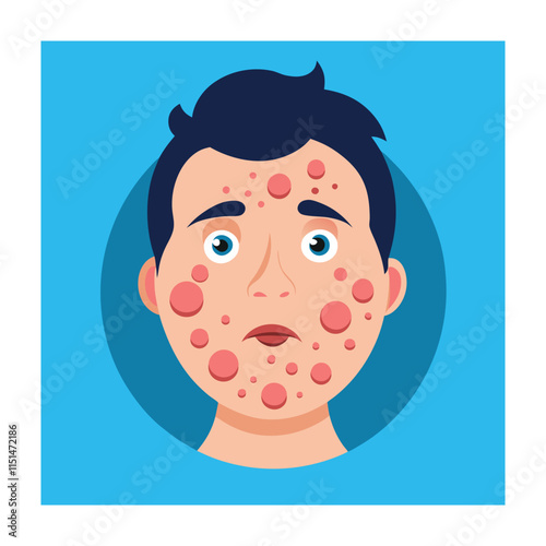 Skin conditions vector illustration