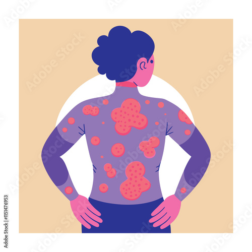 Skin conditions vector illustration