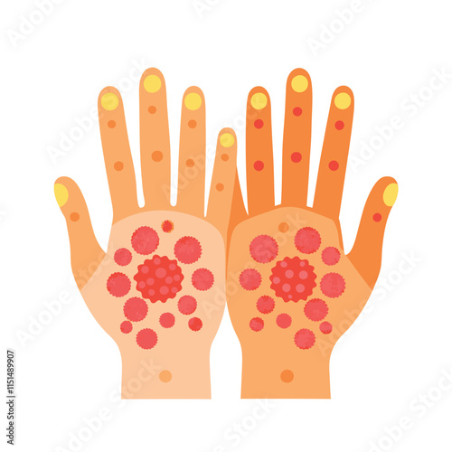 Skin conditions vector illustration