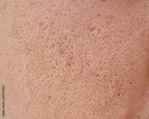 Fotografie pores and oily on surface asian man face