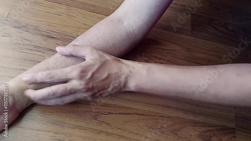 itchy allergy  hives rash eczema atopic dermatitis on arm. inflammation skin