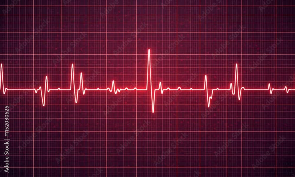 An electrocardiogram (ECG) reading, which graphically represents the heart's electrical activity over time An electrocardiogram (ECG) reading, which graphically represents the heart's electrical activity over time