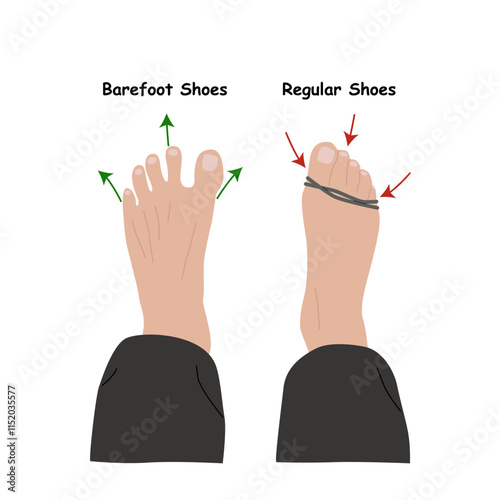 Barefoot shoes. Compare regular vs barefoot shoes. This shoe has a flexible upper and outsole that allows the feet to move and flex naturally, and effectively engage every bone