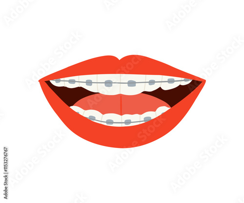 A smile with braces is drawn in a flat style. Healthy smile, braces, lips. Hand drawn vector illustration.